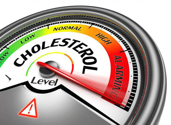 Cách điều trị cholesterol cao bạn nên biết