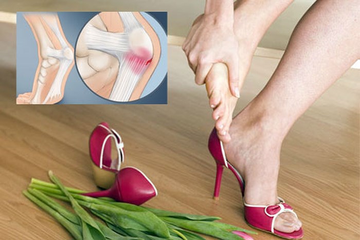 Đừng chủ quan khi bạn bị đau gót chân