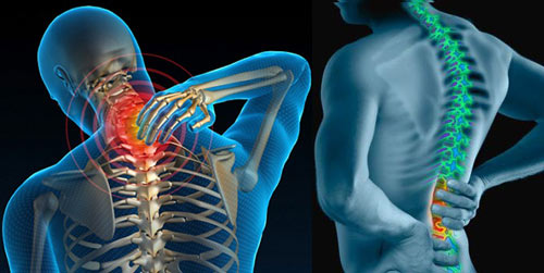 Những môn thể thao phù hợp với người bị thoát vị đĩa đệm