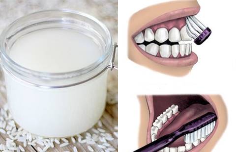 Bật mí cách làm trắng răng an toàn ngay tại nhà?