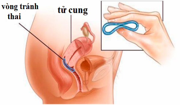 cac-trieu-chung-tam-ly-khi-quan-he-lan-dau-9