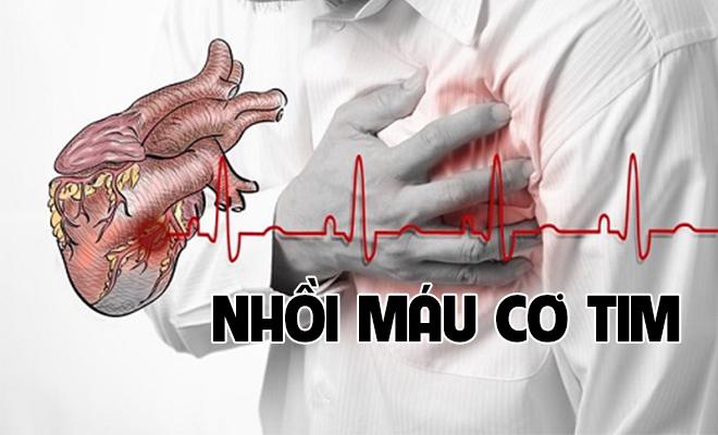 Căn bệnh thầm lặng chết người – Nhồi máu cơ tim3