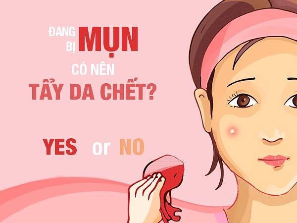 Có nên tẩy da chết khi đang bị mụn không?