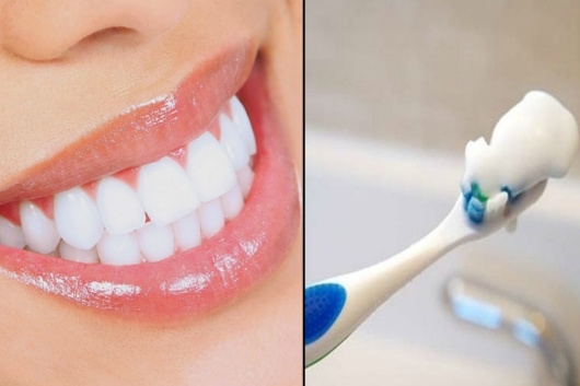 Giải pháp giúp bạn có hàm răng trắng sáng?2