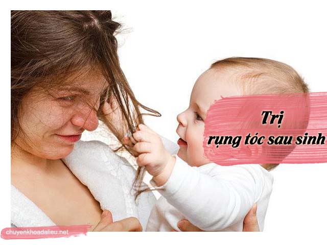 Giảm rụng tóc sau sinh với những biện pháp này?