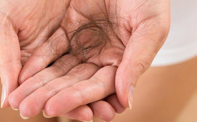 Giảm rụng tóc sau sinh với những biện pháp này?7