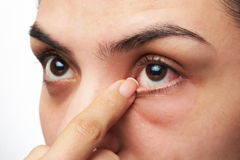 Giúp bạn hiểu hơn về bệnh đau mắt hột?