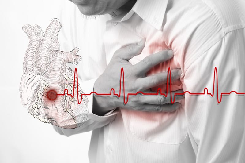 Review bệnh thiếu máu cơ tim có nguy hiểm không?3