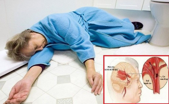 Review nguyên nhân gây bệnh đột quỵ?