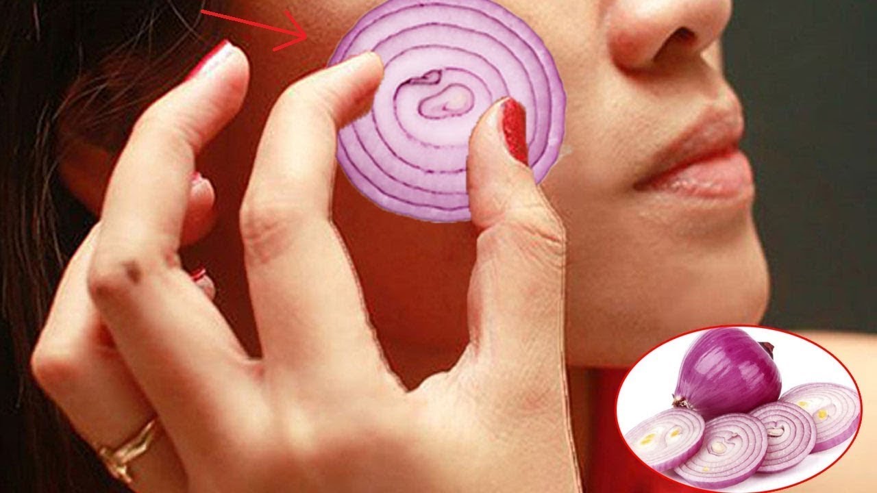 Trị nám da từ tự nhiên làm bao chị em “mê mệt