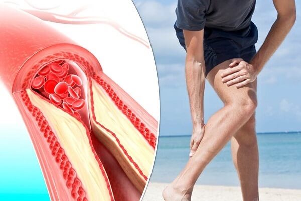 6-bai-tap-giam-dau-chan-do-di-lai-nhieu-4