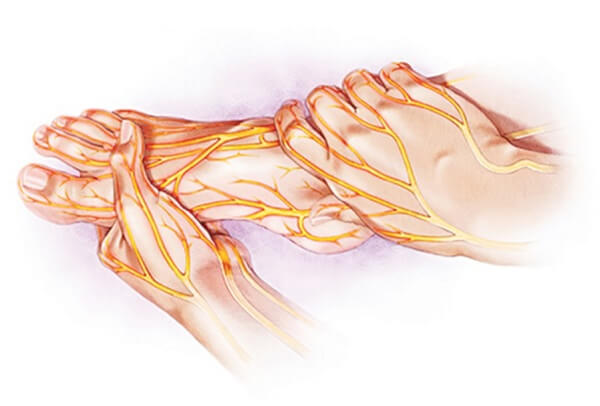 benh-ly-than-kinh-ngoai-bien