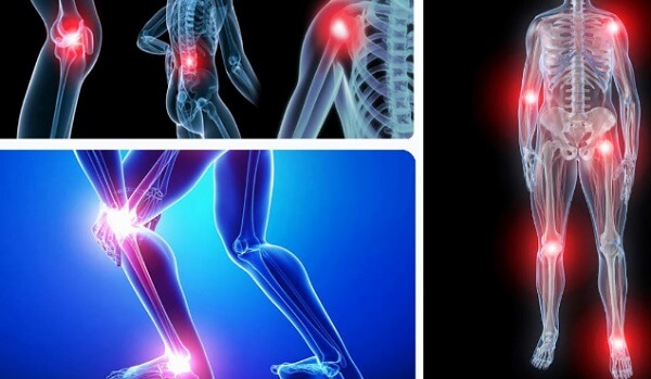 bi-quyet-giup-nguoi-viem-khop-dang-thap-nang-cao-chat-luong-song-4