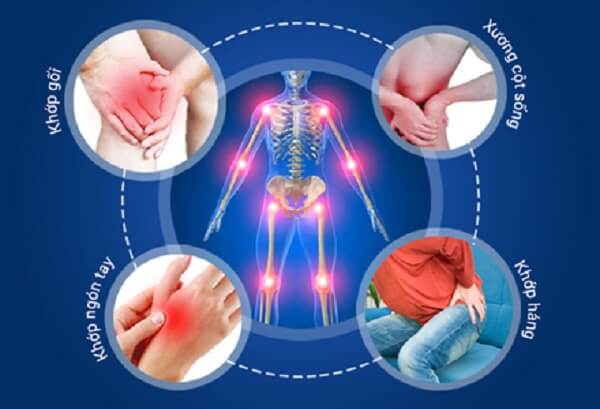 bi-quyet-giup-nguoi-viem-khop-dang-thap-nang-cao-chat-luong-song-5