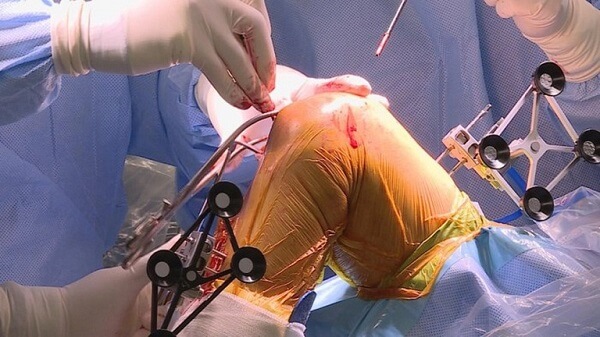 bi-quyet-giup-nguoi-viem-khop-dang-thap-nang-cao-chat-luong-song-6