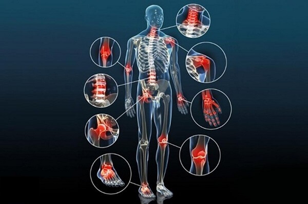 bi-quyet-giup-nguoi-viem-khop-dang-thap-nang-cao-chat-luong-song-8