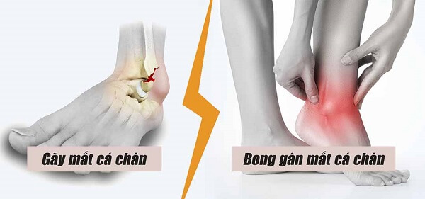 chay-bo-dung-cach-phong-tranh-chan-thuong-2