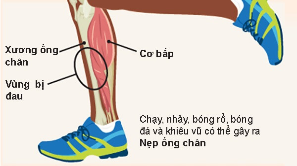 chay-bo-dung-cach-phong-tranh-chan-thuong-5