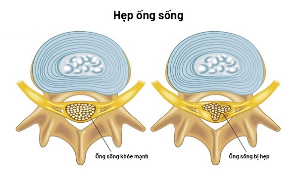 hep-ong-song