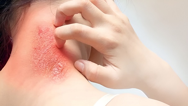 nhiem-trung-mau-co-nguy-hiem-khong-2