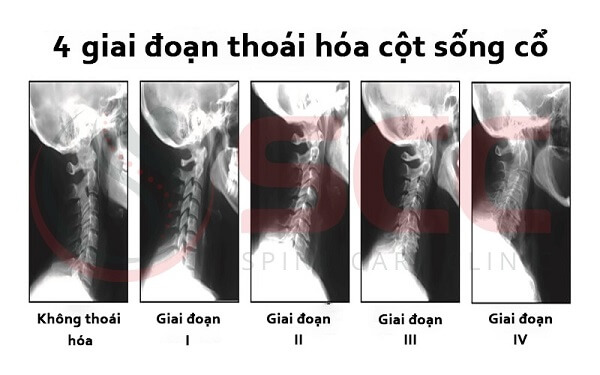 thoai-hoa-cot-song-co