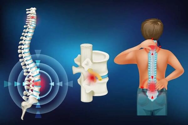 thoat-vi-dia-dem-cot-song-that-lung