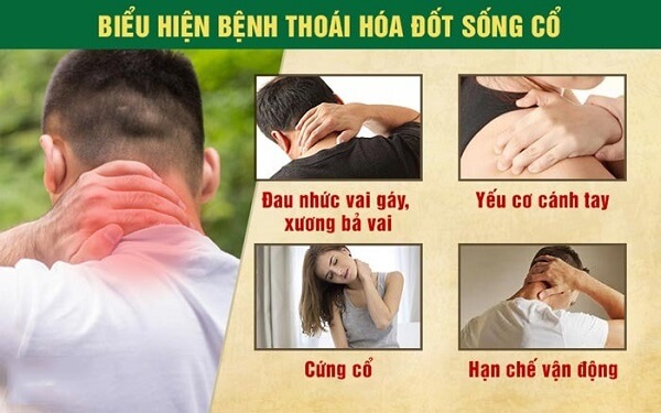 trieu-chung-thoai-hoa-cot-song-co