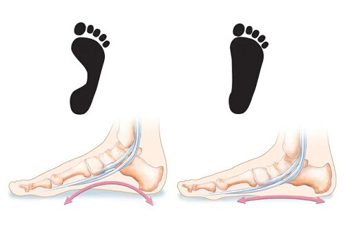 vat-ly-tri-lieu-ban-chan-bet