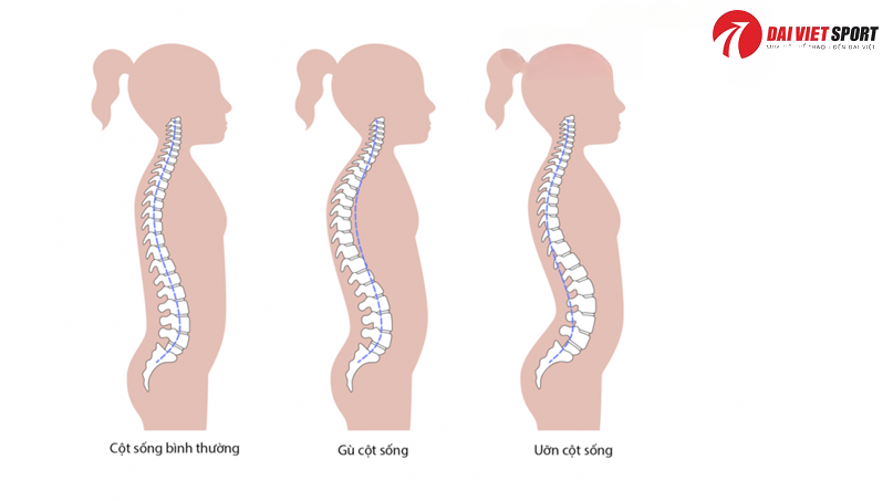 Vật lý trị liệu mất đường cong sinh lý cột sống
