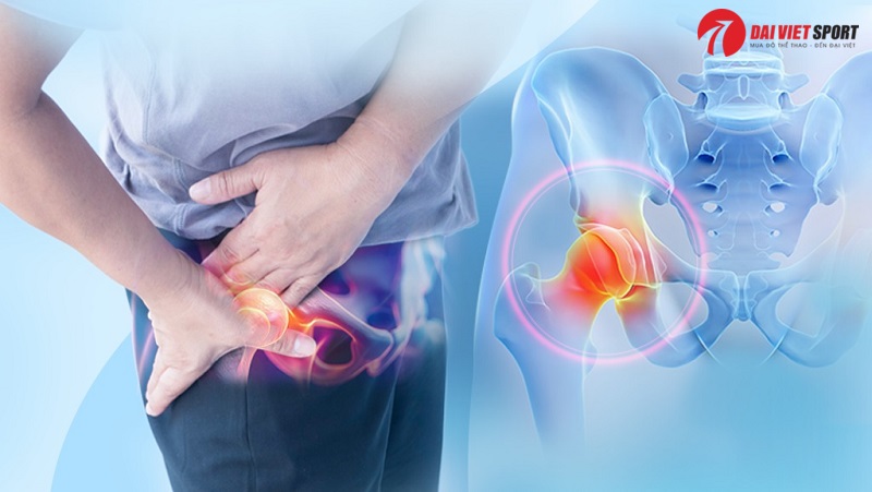 Vật lý trị liệu thoái hóa khớp háng